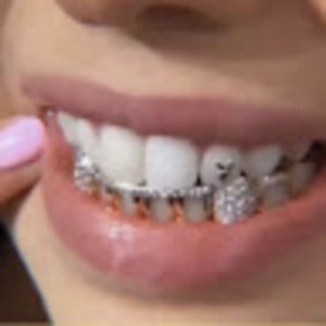 Meet your Posher, Tplazer